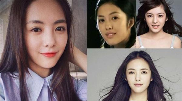 蔡文静整容前的照片曝光(蔡文静鼻子整过吗) 蔡文静整容前的照片曝光(蔡文静鼻子整过吗)