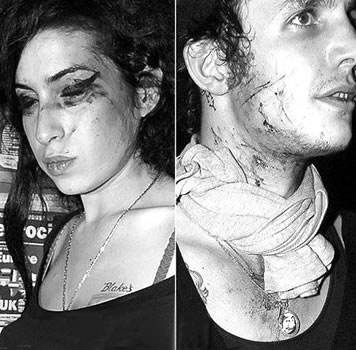 艾米怀恩豪斯烂脸的图片 艾米怀恩豪斯烂脸的图片