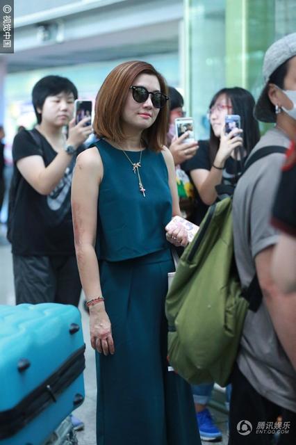 罕见selina的真实烧伤照片(selina烧伤时真实视频)