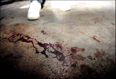 鄢颇被砍伤现场图片(鄢颇伤势好了吗) 鄢颇被砍伤现场图片(鄢颇伤势好了吗)