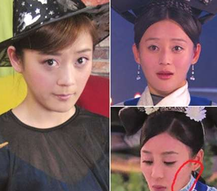 袁珊珊整容前后照片(袁姗姗好丑) 袁珊珊整容前后照片(袁姗姗好丑)