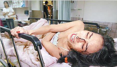 许纯美被情郎打图片 许纯美被情郎打图片