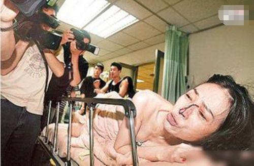 许纯美被情郎打图片 许纯美被情郎打图片