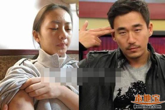 张默为什么打童瑶？张默是同性恋是真的假的(童瑶张默事件真相)