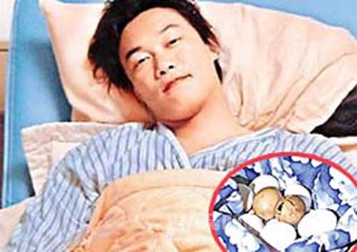 陈奕迅为什么叫所长？陈奕迅的睾丸是怎么没(陈奕迅为什么叫院长)