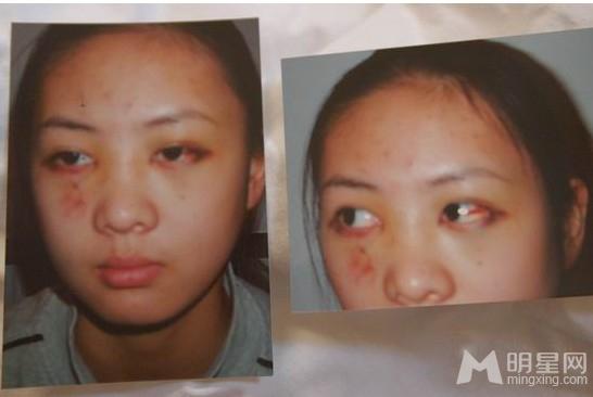 张默为什么打童瑶？张默是同性恋是真的假的(童瑶张默事件真相)