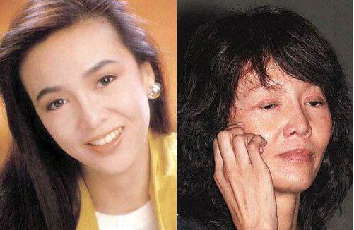 郑裕玲整容美貌变惊悚(郑裕玲脸怎么塌了) 郑裕玲整容美貌变惊悚(郑裕玲脸怎么塌了)