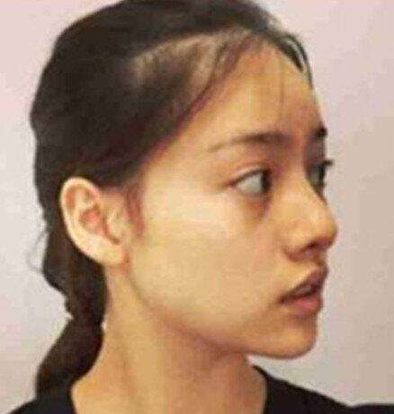 演员张艺上整容前真吓人图(演员张艺上图片) 演员张艺上整容前真吓人图(演员张艺上图片)