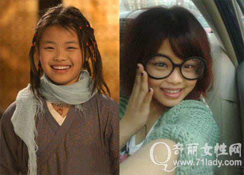 王莎莎整容后的照片(王莎莎瘦了)