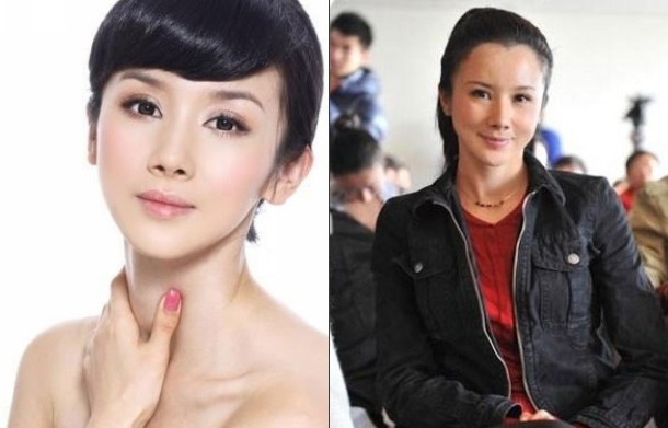 孙菲菲整容整成僵尸脸图(孙菲菲什么时候整的容)