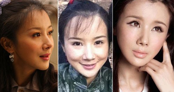 孙菲菲整容整成僵尸脸图(孙菲菲什么时候整的容)