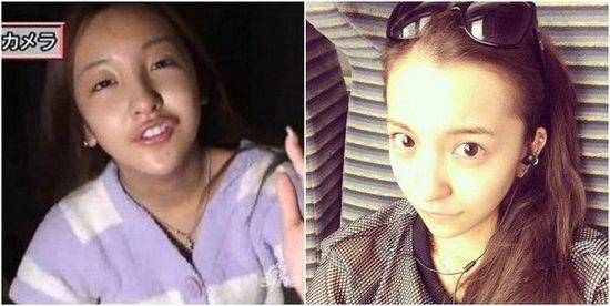 板野友美为什么叫虎牙？板野友美整容前后对(板野友美和谁关系好)