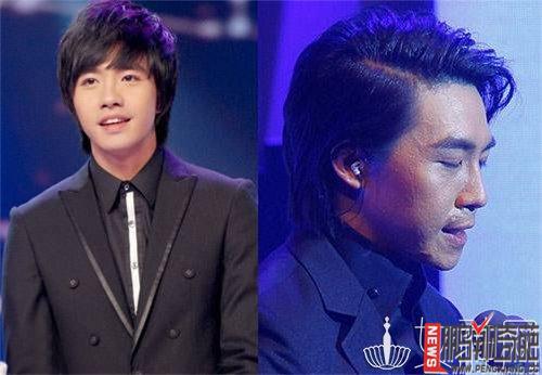 为什么俞灏明贴吧禁郑爽？俞灏明烧伤事件赔(俞灏明烧伤事件真相)