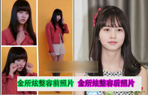 金所炫为什么不上高中？金所炫承认自己整容(金所炫不漂亮)