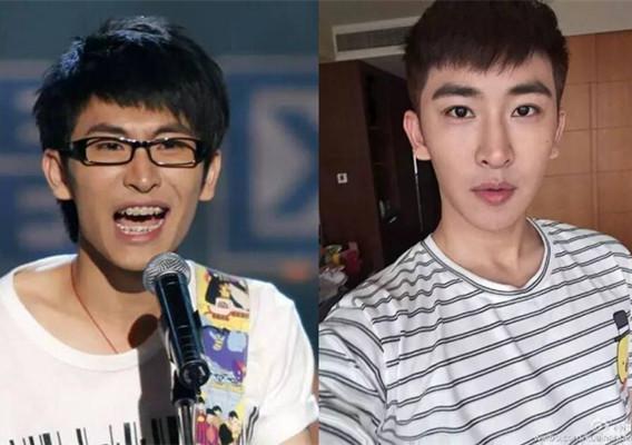 谭杰希谭佑铭整容前后对比图(谭杰希以前照片)