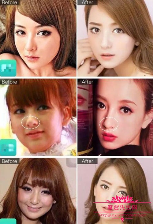 方媛和郭富城怎么好上的？方媛整容前后对比(郭富城娶方媛是有原因的)