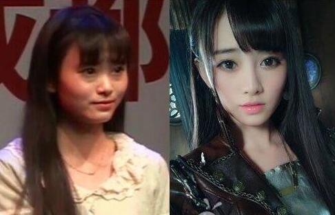 郑湫泓是不是做过牙齿整容(郑湫泓为什么这么漂亮) 郑湫泓是不是做过牙齿整容(郑湫泓为什么这么漂亮)