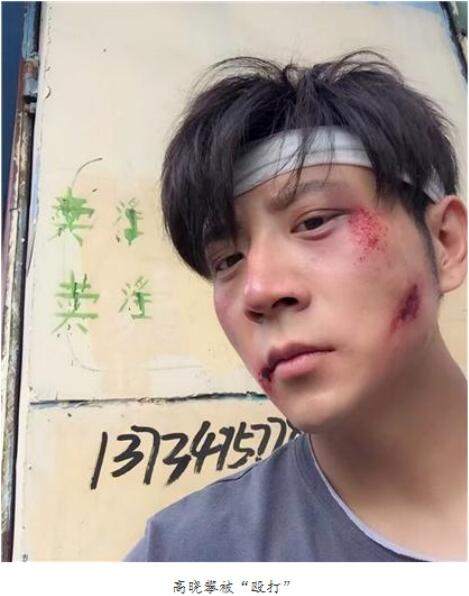 高晓攀和高晓松什么关系？高晓攀北京台丢人