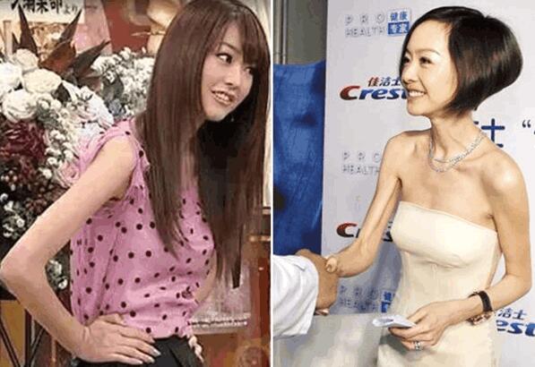 桐谷美玲没有生理期体重轻得吓人 桐谷美玲没有生理期体重轻得吓人