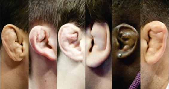 阿米尔汗怎么这么矮?阿米尔汗的耳朵怎么了