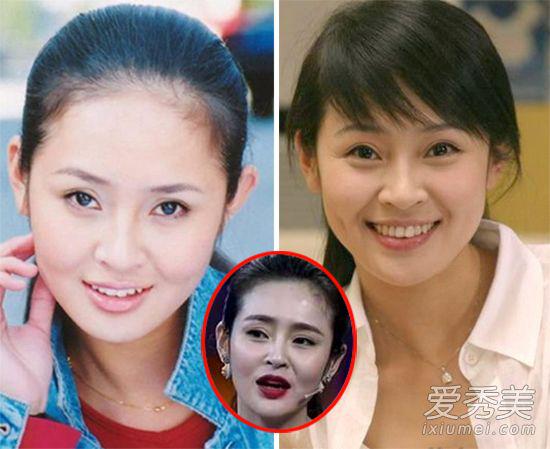 于明加整容前后对比照片(于明加颜值) 于明加整容前后对比照片(于明加颜值)