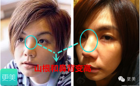 ella的老公赖斯翔身价多少？ella为