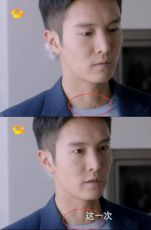 盛一伦脖子上的伤疤是怎么回事？盛一伦上快