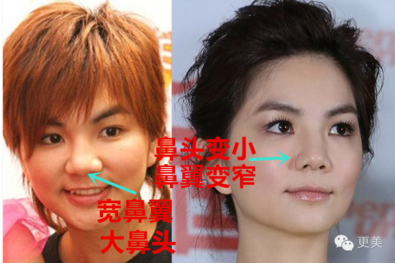 ella的老公赖斯翔身价多少？ella为