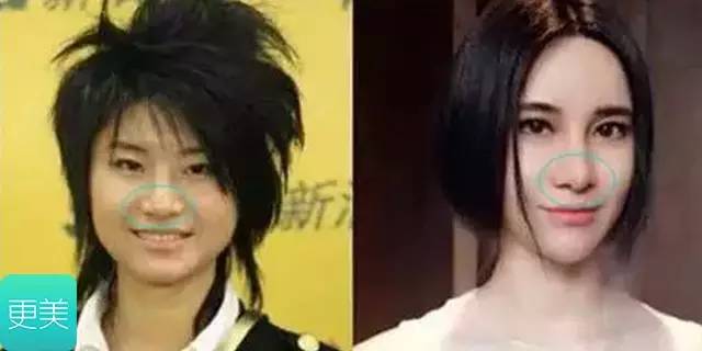 ella的老公赖斯翔身价多少？ella为