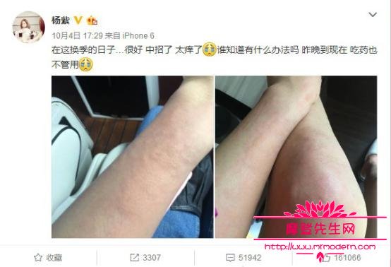 杨紫腿毛茂密引围观图片(杨紫最罕见的美图)