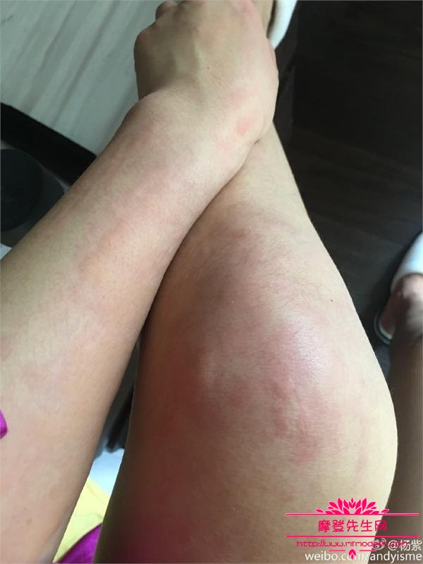 杨紫腿毛茂密引围观图片(杨紫最罕见的美图) 杨紫腿毛茂密引围观图片(杨紫最罕见的美图)