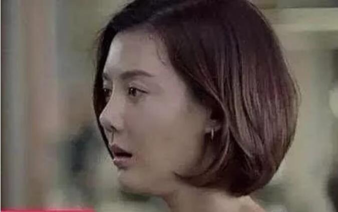 车晓的鼻子怎么回事是朝天鼻吗(车晓的鼻子变好看了) 车晓的鼻子怎么回事是朝天鼻吗(车晓的鼻子变好看了)