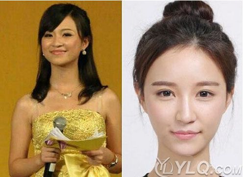 朱宸慧为什么叫雪梨？朱宸慧王思聪为什么分