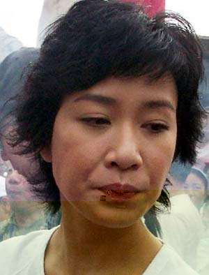 佘诗曼下巴的疤痕照片(佘诗曼下嘴唇有个疤) 佘诗曼下巴的疤痕照片(佘诗曼下嘴唇有个疤)