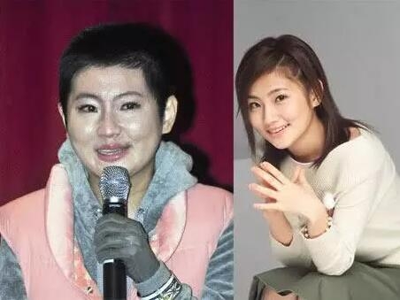 任家萱俞灏明烧伤事件始末真相如何(任家萱和俞灏明拍什么电视剧烧伤的) 任家萱俞灏明烧伤事件始末真相如何(任家萱和俞灏明拍什么电视剧烧伤的)