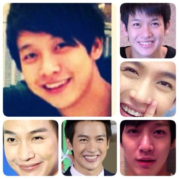 普提查·克瑟辛整容前照片(普提查·克瑟辛太帅了) 普提查·克瑟辛整容前照片(普提查·克瑟辛太帅了)