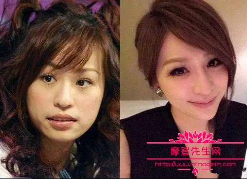 王心凌脸坑洼恐怖近照(王心凌的脸出什么事)