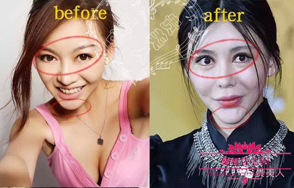 巩新亮为什么和金星对骂？巩新亮的整容有多(金星评价巩新亮视频)