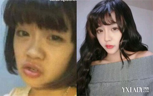 韩安冉得了什么病(韩安冉的病)