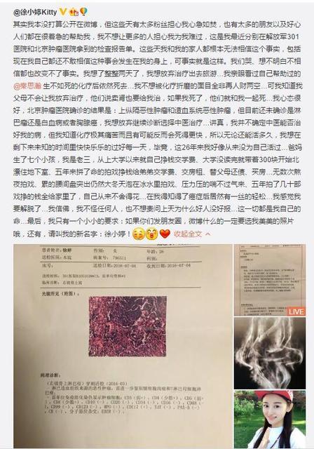 90后女演员徐婷临终前照片(徐婷 剧照)